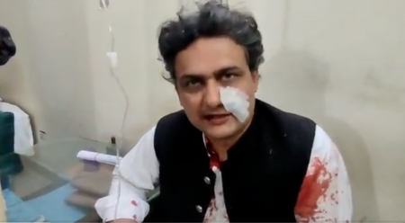 Fostul premier pakistanez Imran Khan, &icirc;mpuşcat şi rănit la un marş antiguvernamental &icirc;n Lahore, &icirc;ntr-o aparentă tentativă de asasinat; Viaţa nu-i este &icirc;n pericol
 - poza 1